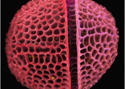 imagen mircoscopiaca diatomeas